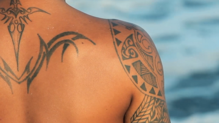 PiQo4, Tattoo removal, tattoo, lumenis