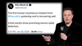 Elon Musk announces first implanted “brain chip” from company Neuralink 